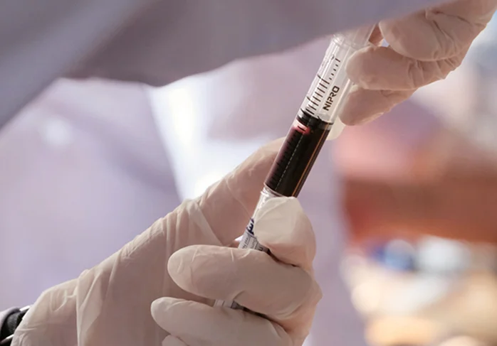 Prelievo per donazione in aferesi